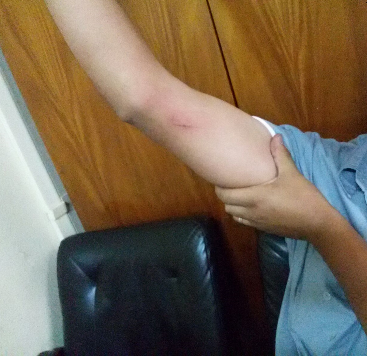 Marcas no corpo do motorista denunciam agressão